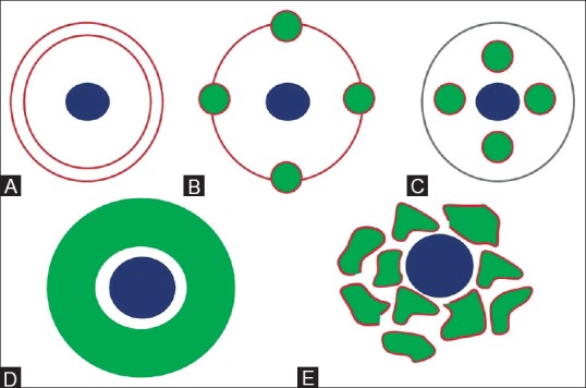 Figure 1 (A-E)