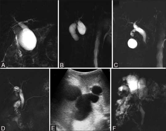 Figure 11 (A-F)