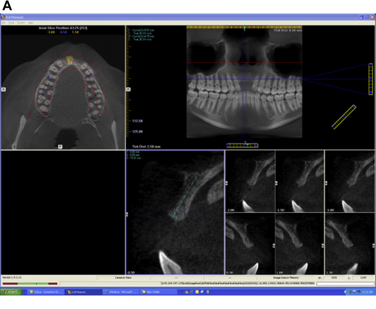 Fig. 4