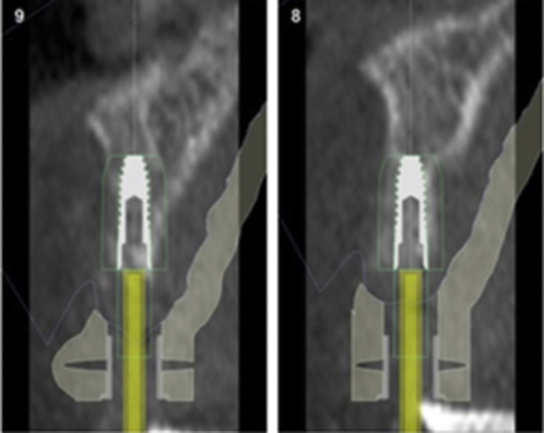 Fig. 6