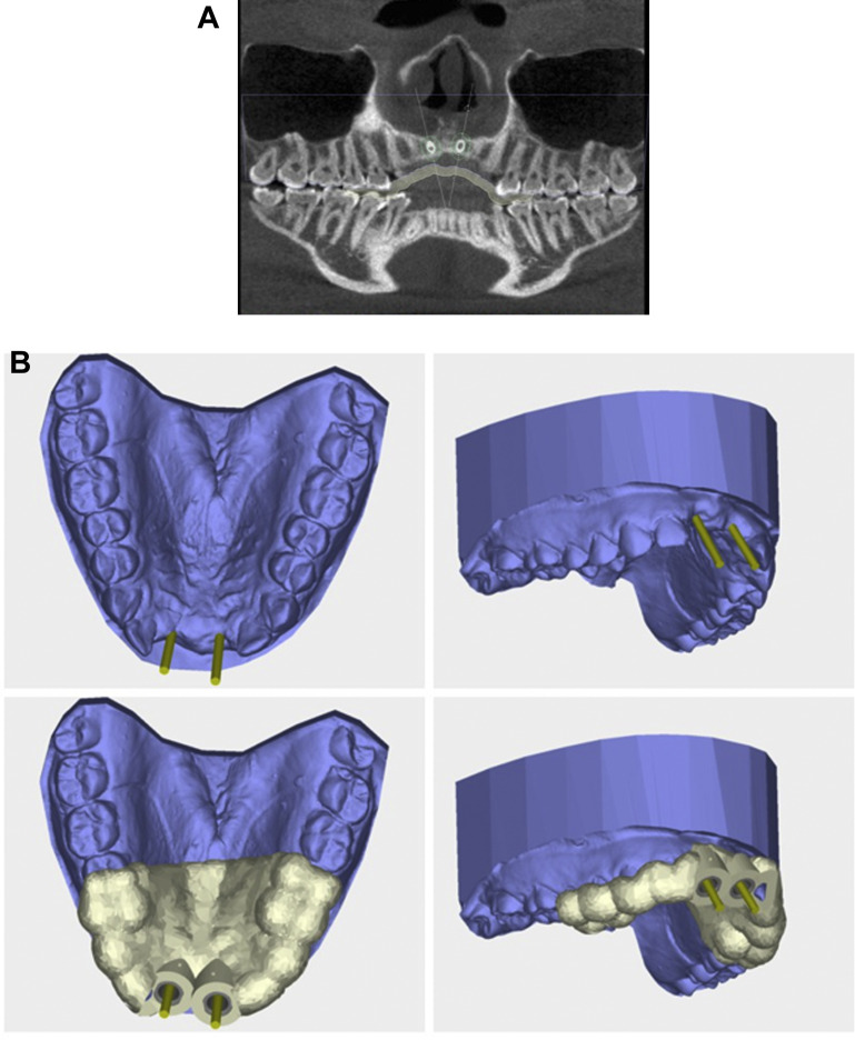 Fig. 5