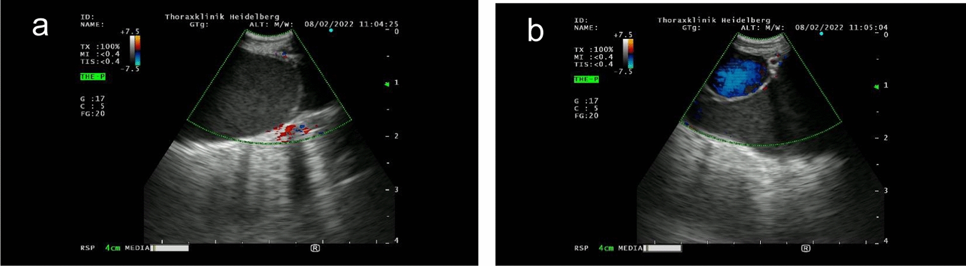 Fig. 1