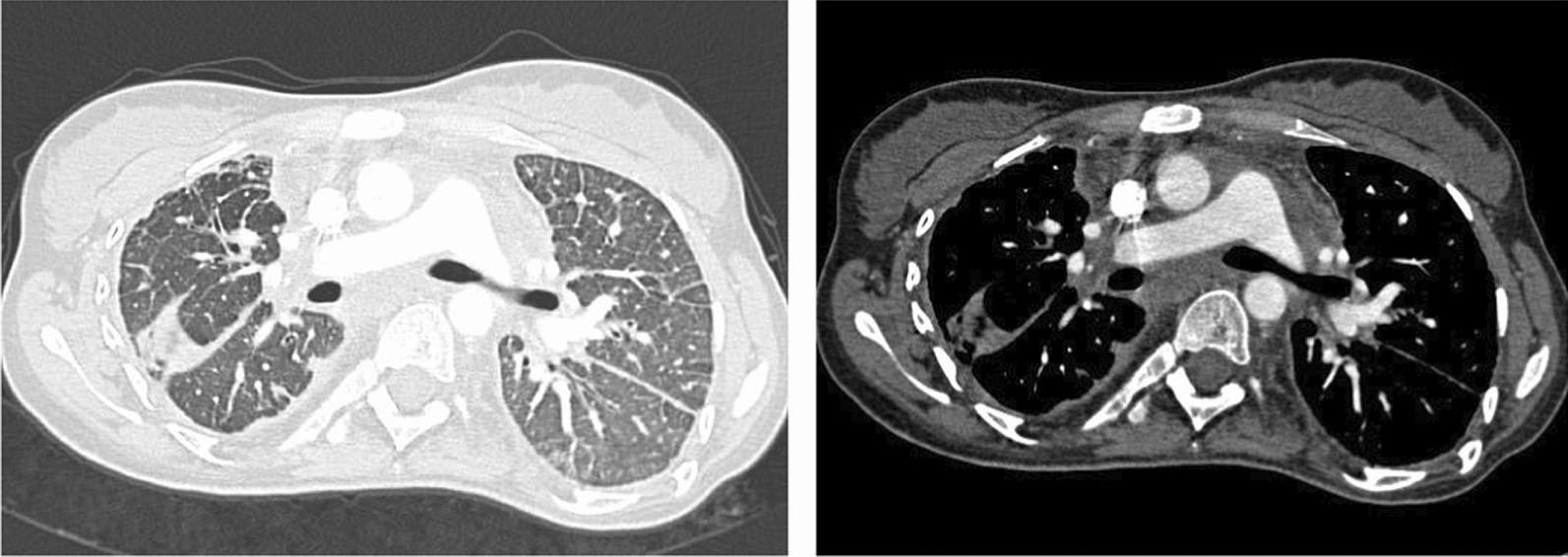 Fig. 2