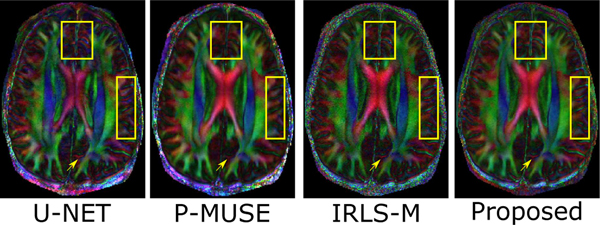 Fig. 12.