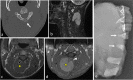 Fig. 25