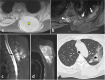 Fig. 21