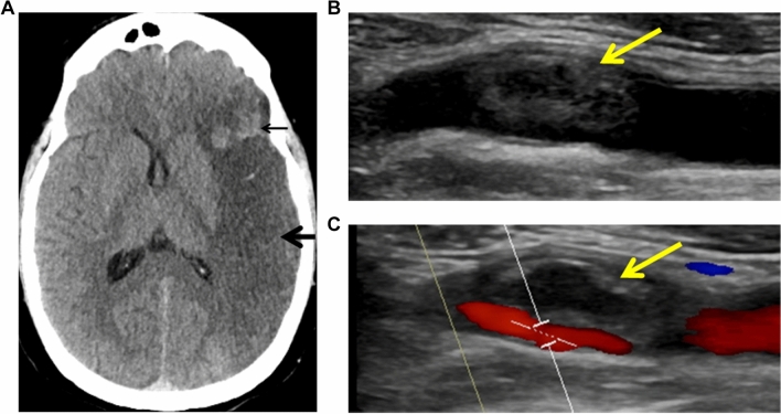 Fig. 1