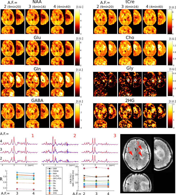 FIG. 4: