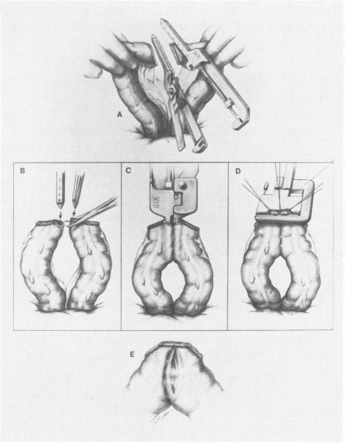 Figs. 3a-e.