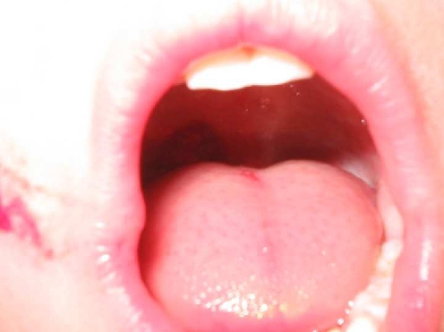 Fig. 1