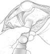 Fig. 3