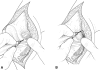 Fig. 2A–B