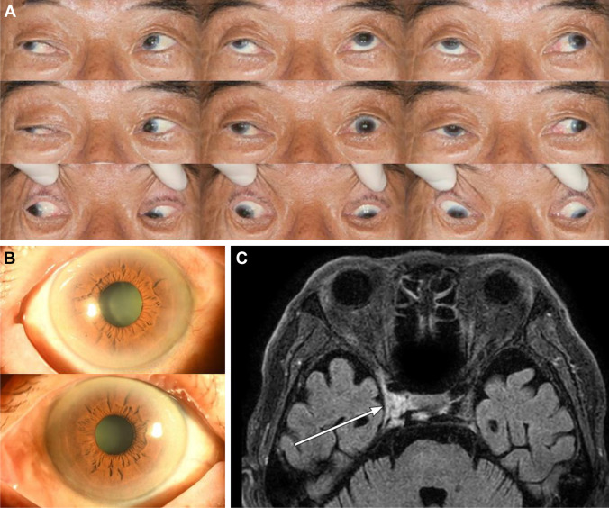 Fig. 1