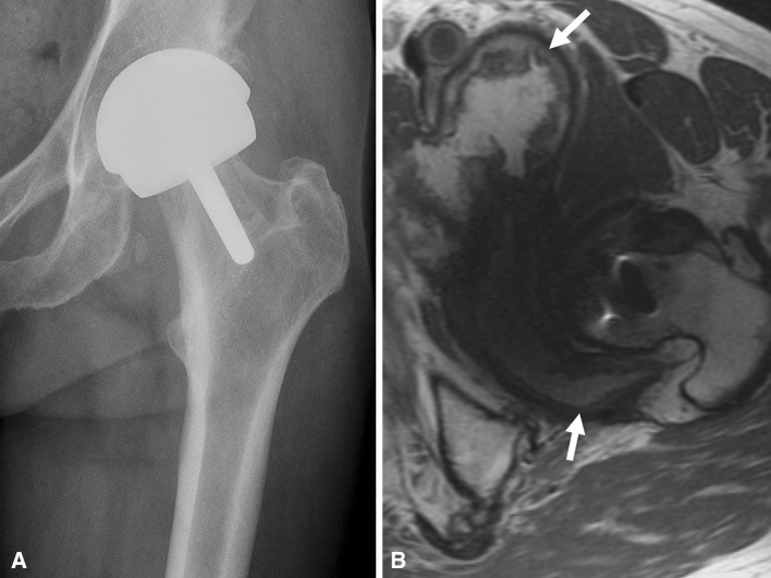 Fig. 8A–B