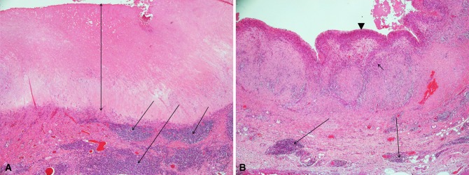 Fig. 1A–B