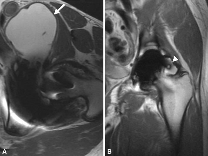 Fig. 7A–B