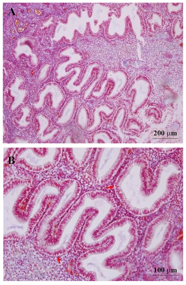 Fig.1