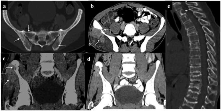 Figure 18.