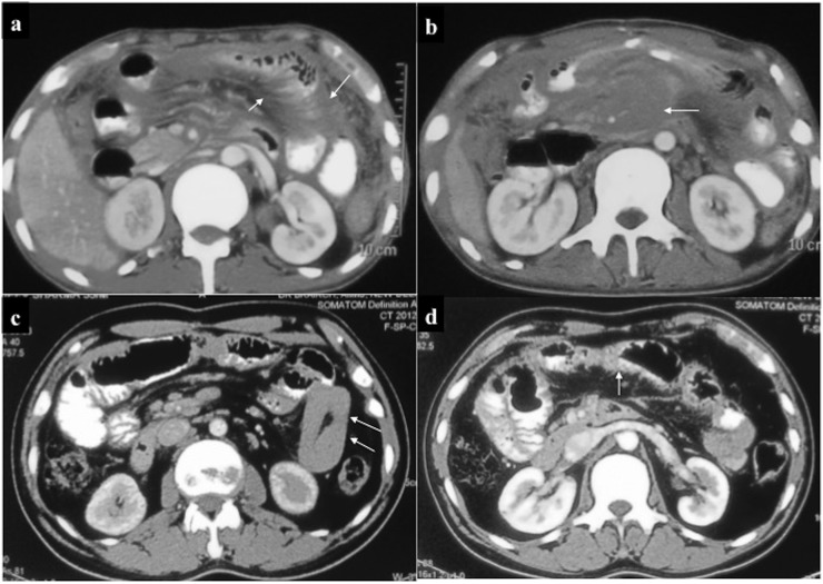 Figure 14.