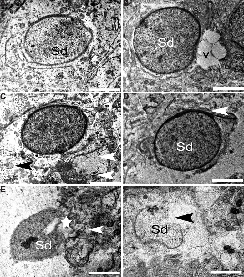 Fig. 11