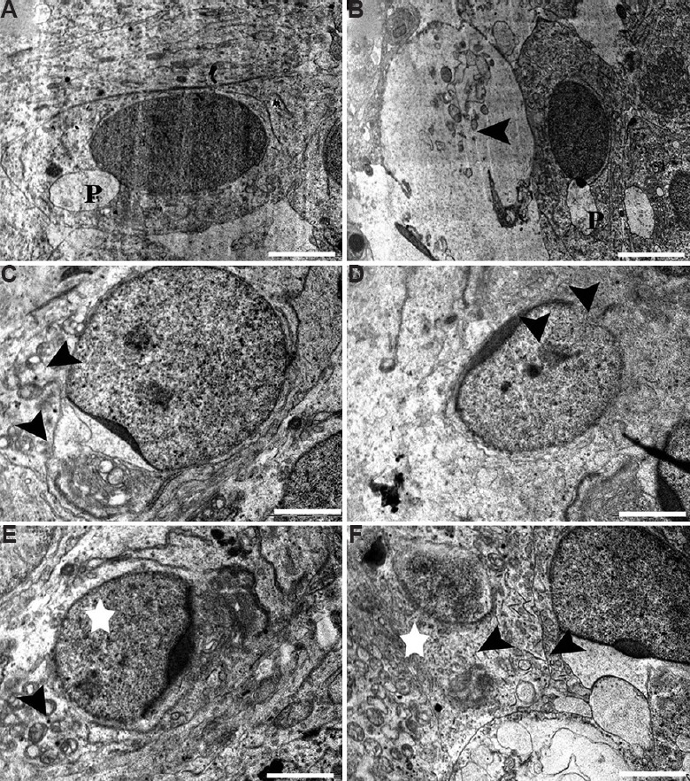 Fig. 12