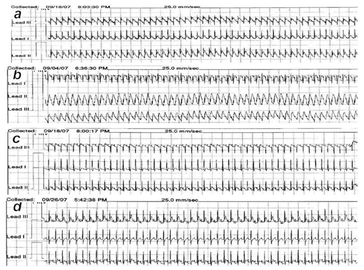 Figure 17