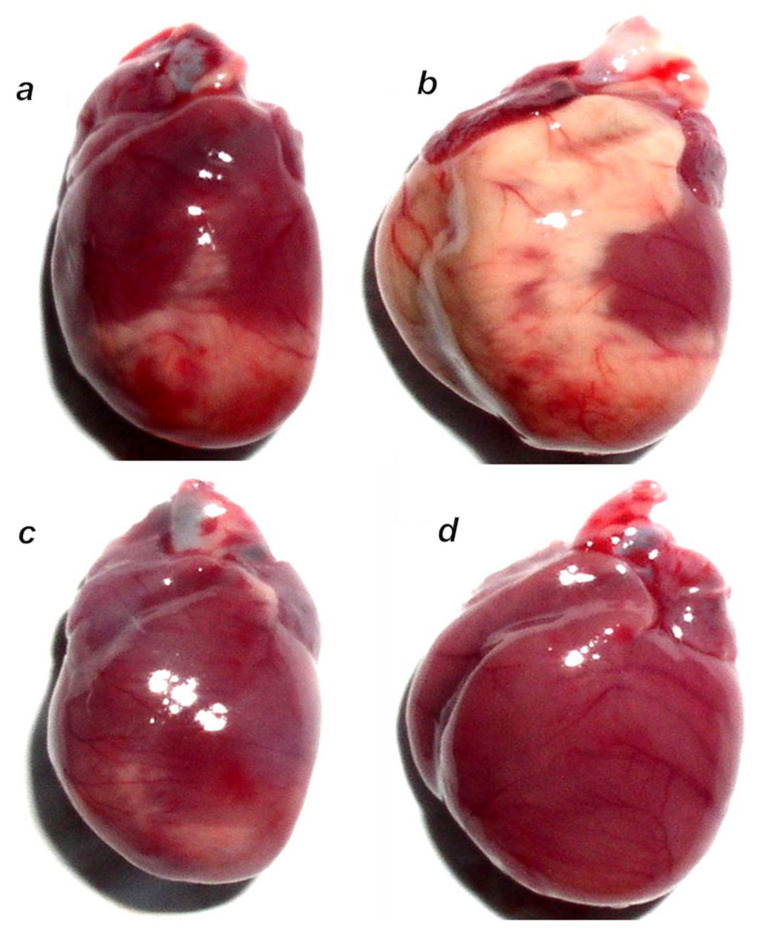 Figure 14