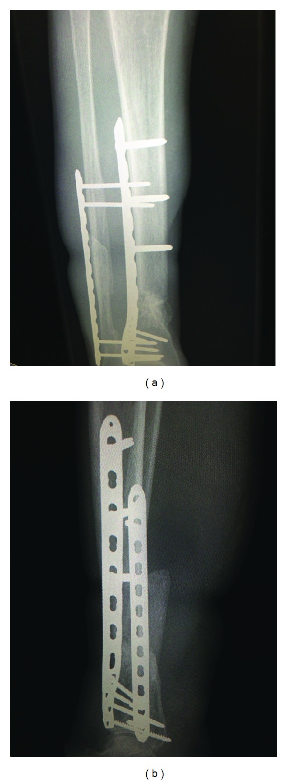 Figure 4