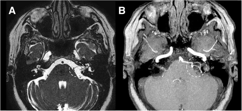 Fig. 30