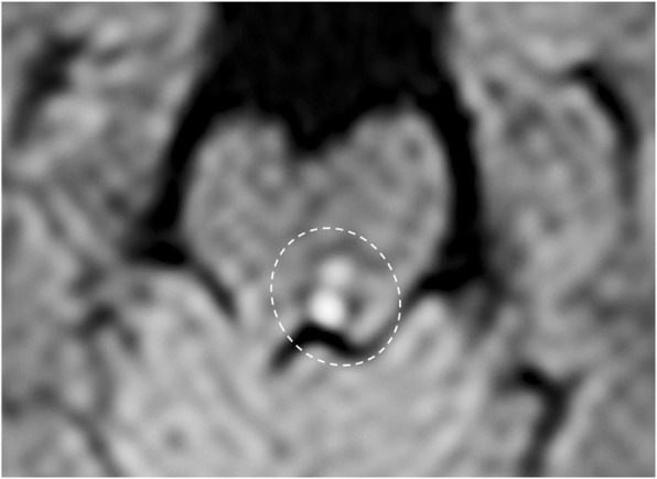 Fig. 32