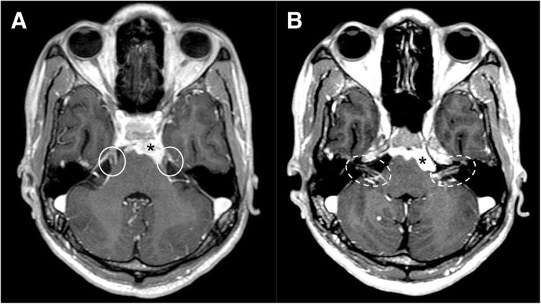 Fig. 28