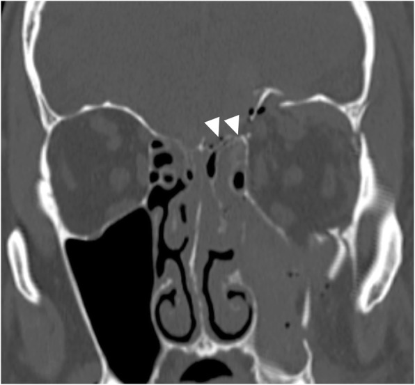 Fig. 29