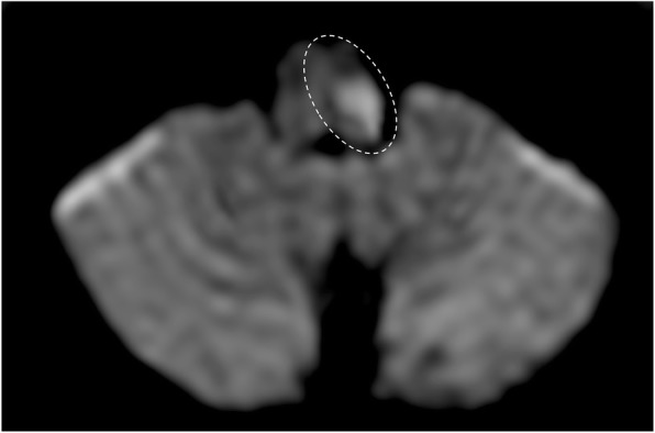 Fig. 31
