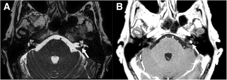 Fig. 11