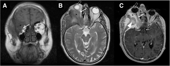 Fig. 23