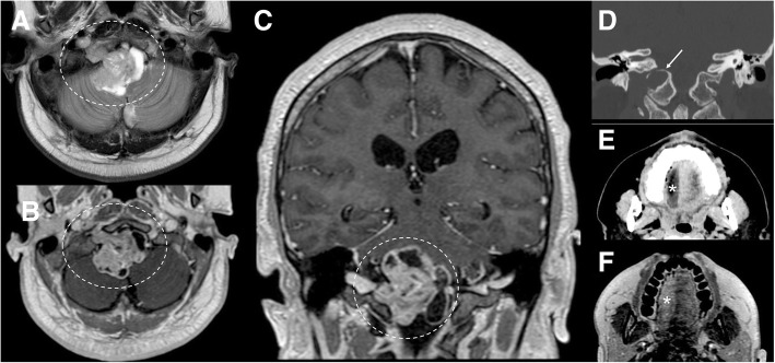 Fig. 14