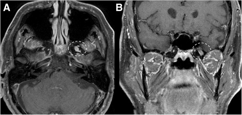 Fig. 21