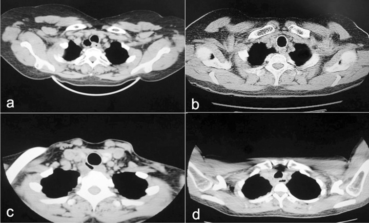 Fig.1