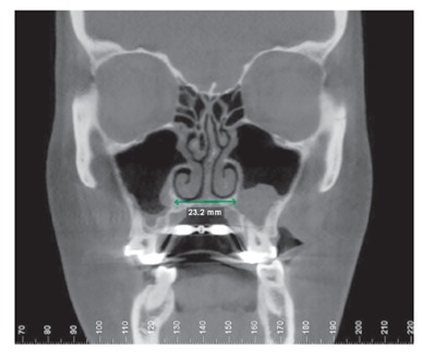 Figure 24