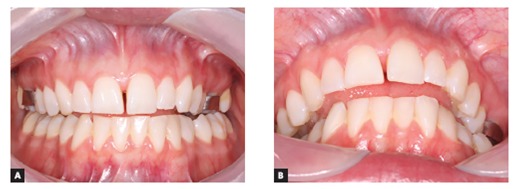 Figure 17