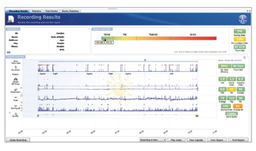 Figure 25