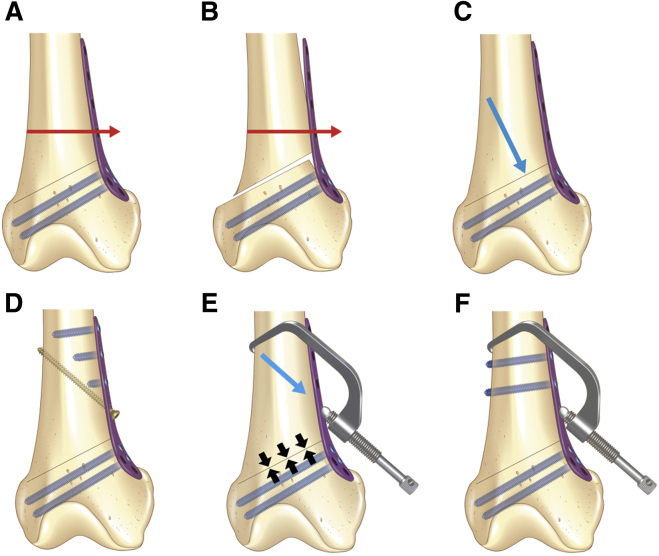 Fig 8