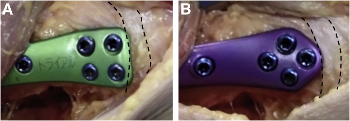 Fig 2