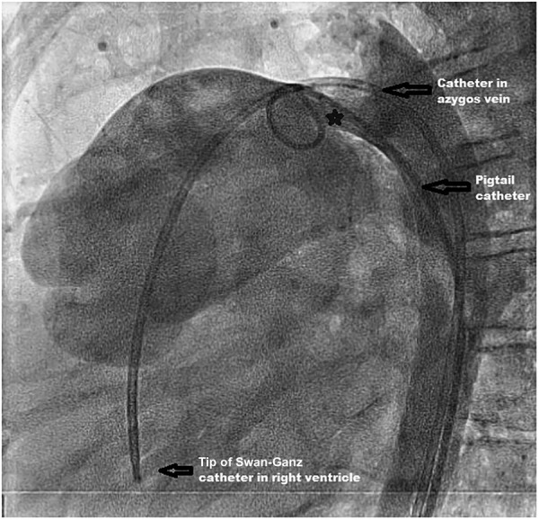 Figure 3