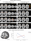 Within-Group and Group x Time Interaction Brain Activation Clusters