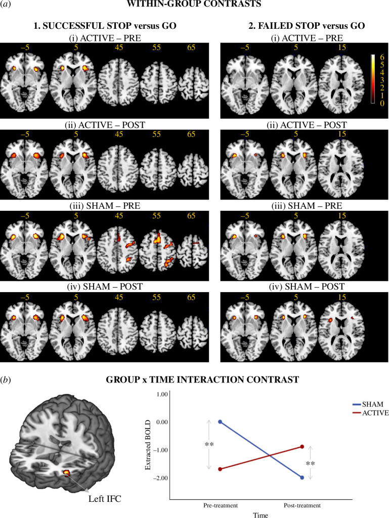 Within-Group and Group x Time Interaction Brain Activation Clusters