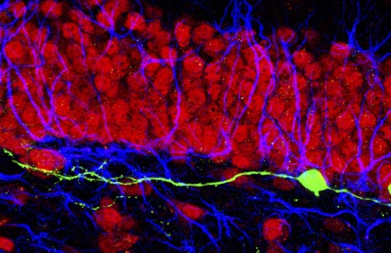 Newborn neurons deficient in cdk5 (green) extend aberrant dendrites that nonetheless synaptically integrate into the pre-existing dentate circuitry containing neurons (red) and glial cells (blue).