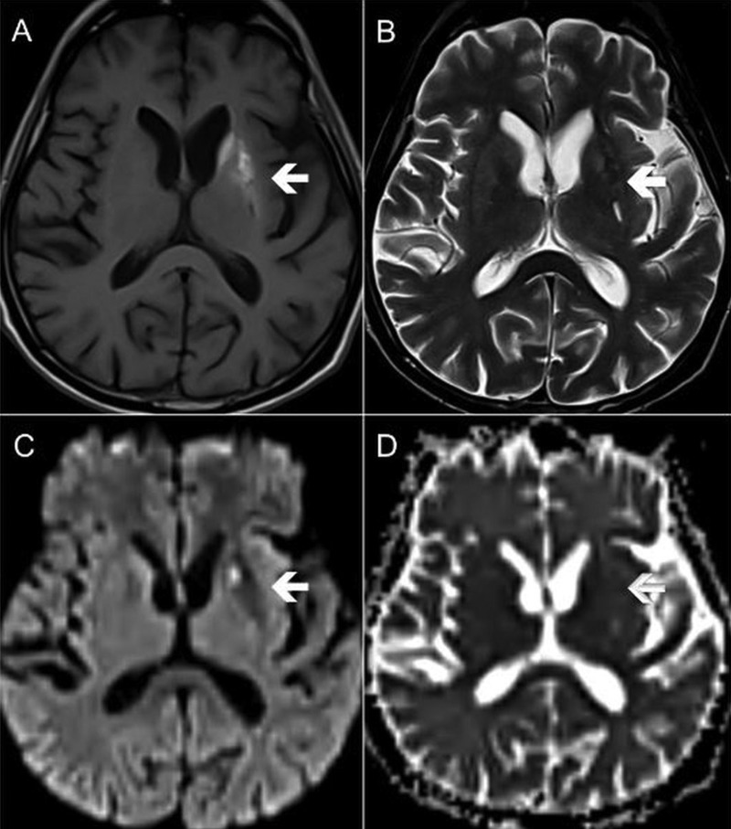 Figure 2