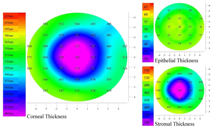 Figure 11