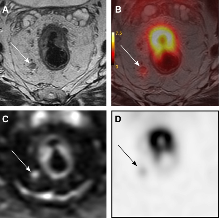 Fig. 5